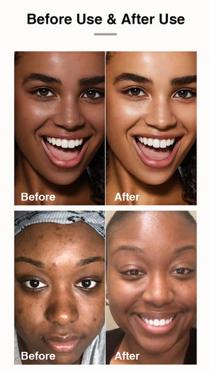 Unisex AILKE Turmeric Skin Care for acne and pore refining with brightening effects, featuring turmeric and natural ingredients.
