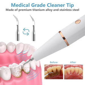 Hot Trend Vault Hailicare ultrasonic dental scaler for home use, removing calculus, stains, tartar, and whitening teeth.