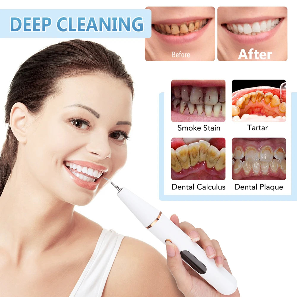 Hot Trend Vault Hailicare ultrasonic dental scaler for home use, removing tartar, stains, and whitening teeth effectively.