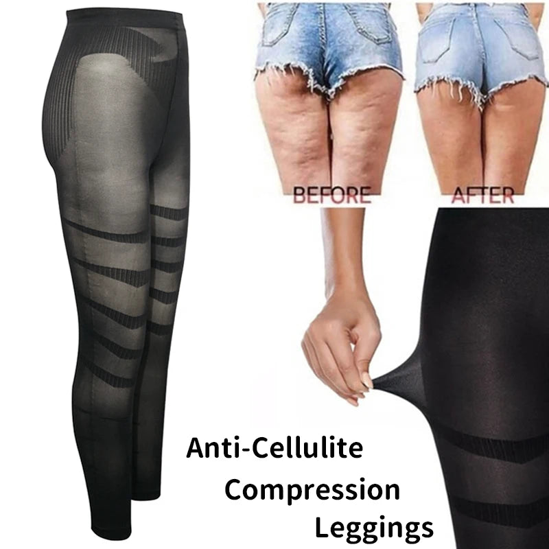 Hot Trend Vault Miss Moly anti-cellulite leggings for women with thigh sculpting and waist shaping, shown on a model.