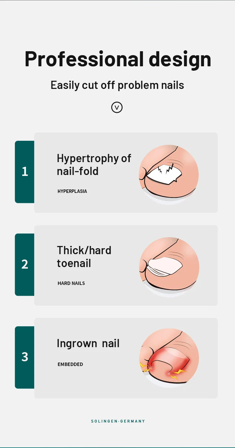 MR.GREEN Nail Clippers Toenail Cutters Pedicure Manicure Tools  Ingrown Paronychia Professional Correction Tool Sets