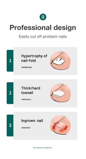 MR.GREEN ingrown Nail Clippers Toenail Cutter Stainless Steel Pedicure Tools Thick Toe Nail Correction Deep Into Nail Grooves