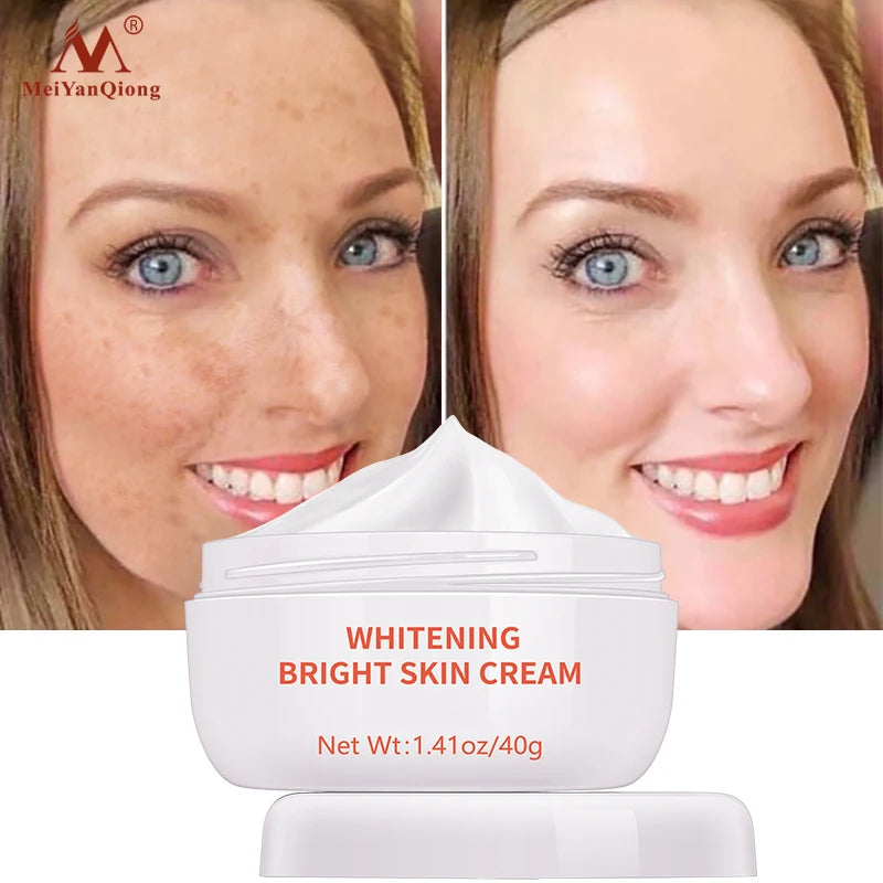 MeiYanQiong dark spot remover cream for women with snail extract, shown in a white jar with a pink lid and product label.