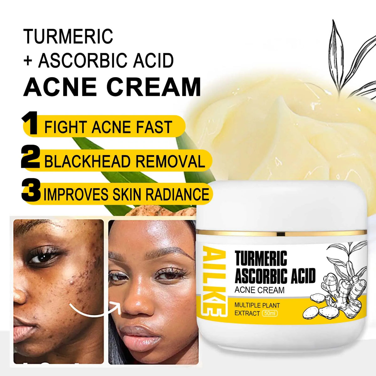 Hot Trend Vault AILKE Turmeric Skin Care bottle for acne, pore refinement, and skin brightening, unisex skincare product on a white background.