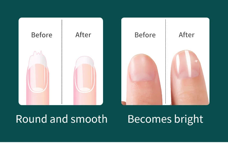 MR.GREEN Manicure Set Pedicure Sets Nail Clipper Stainless Steel Professional Nail Cutter Tools with Travel Case Kit