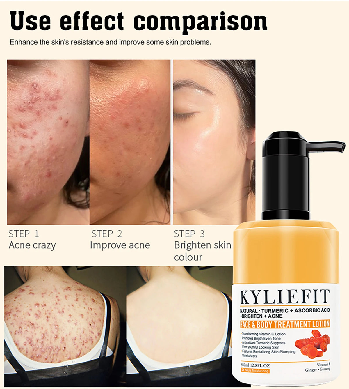 AILKE Turmeric Skin Care acne treatment bottle with label, designed for pore refining and brightening, unisex skincare product.