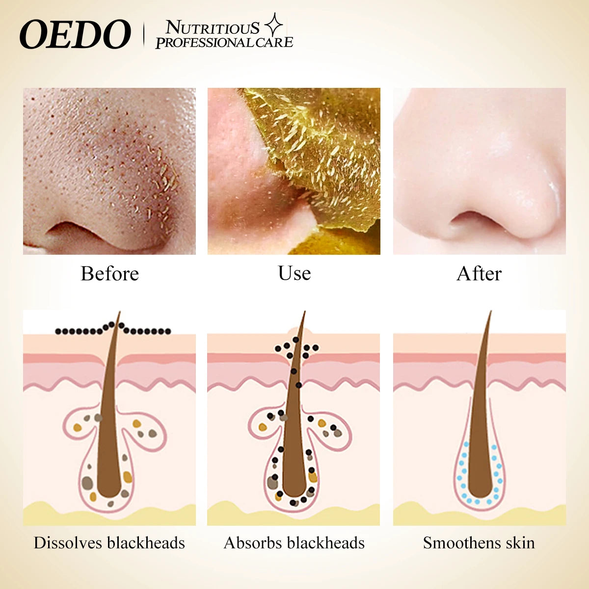 Blackhead Removal Mask Shrink Pores Clean Pores Improve Rough Skin Removal Acne Blackhead Mask Whitening  Moisturizing Face Care