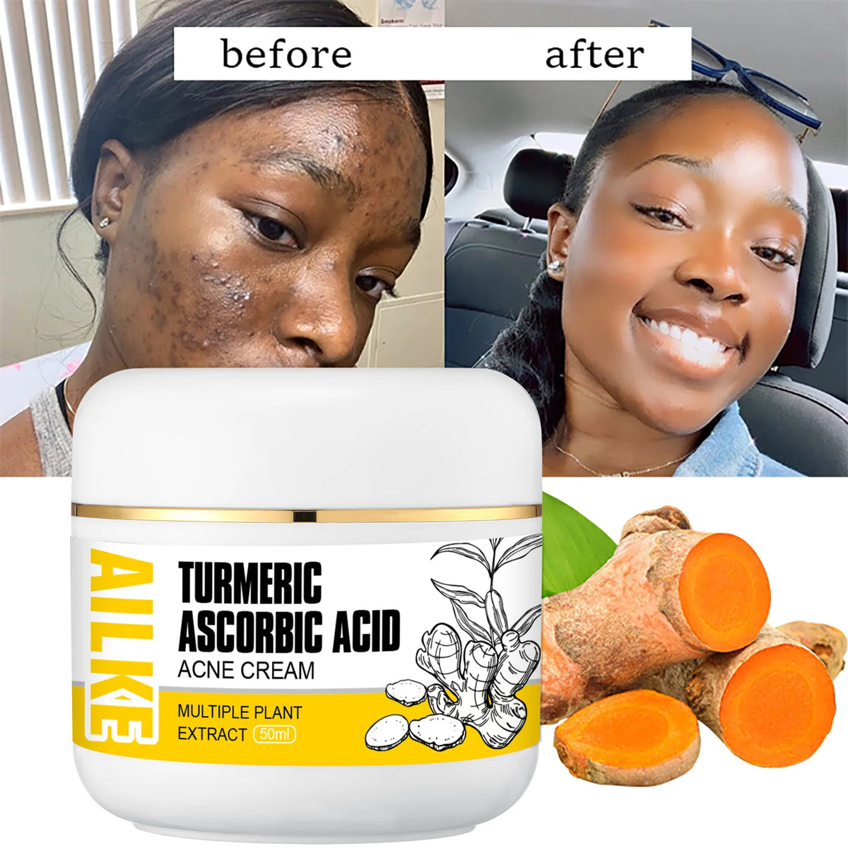 Turmeric skin care product for acne and pore refining by Hot Trend Vault, unisex facial treatment with natural ingredients.