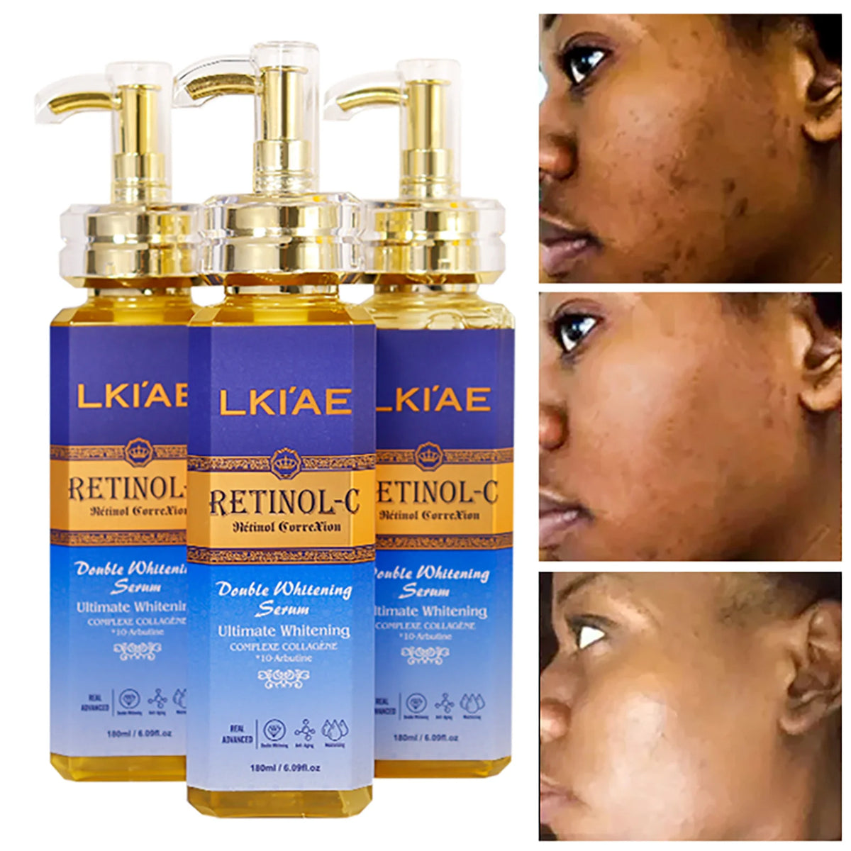 AILKE Retinol Whitening Skin Care Set by Hot Trend Vault, featuring anti-wrinkle, dark spot reduction, and moisturizing soap for all skin types.