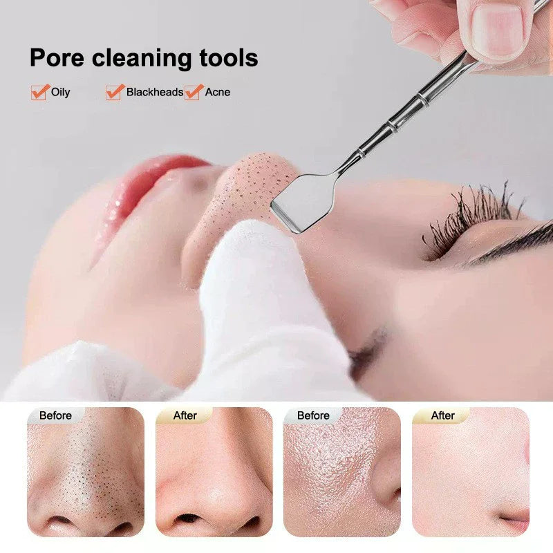 Blackhead removal tool by Hot Trend Vault, stainless steel nose spatula for deep cleansing and all skin types.