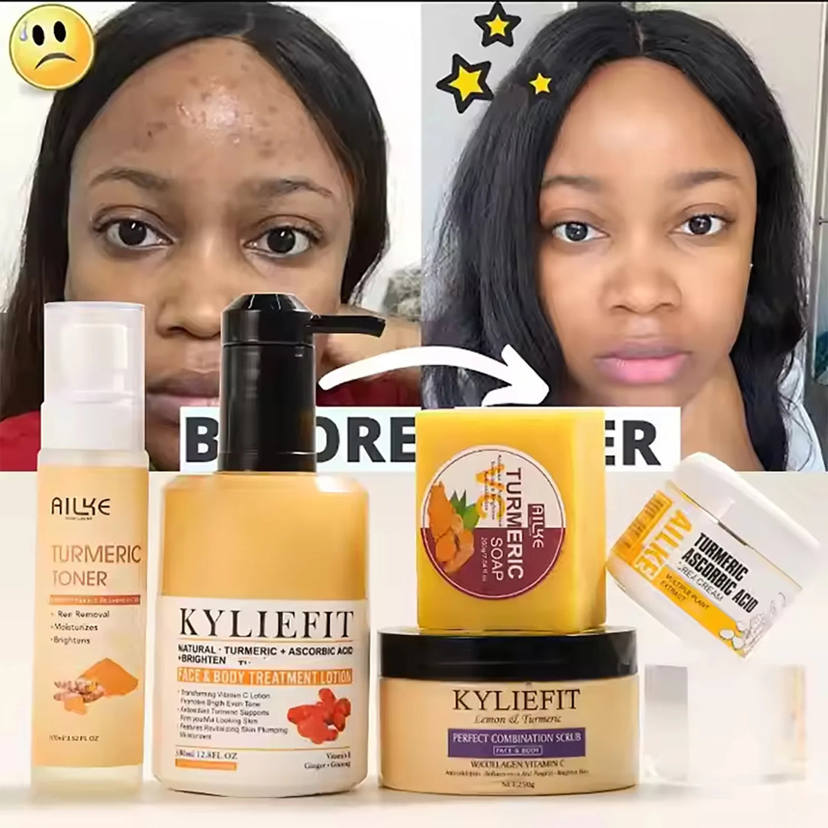 Unisex AILKE Turmeric Skin Care bottle for acne, pore refining, and brightening in sleek packaging on a white background.