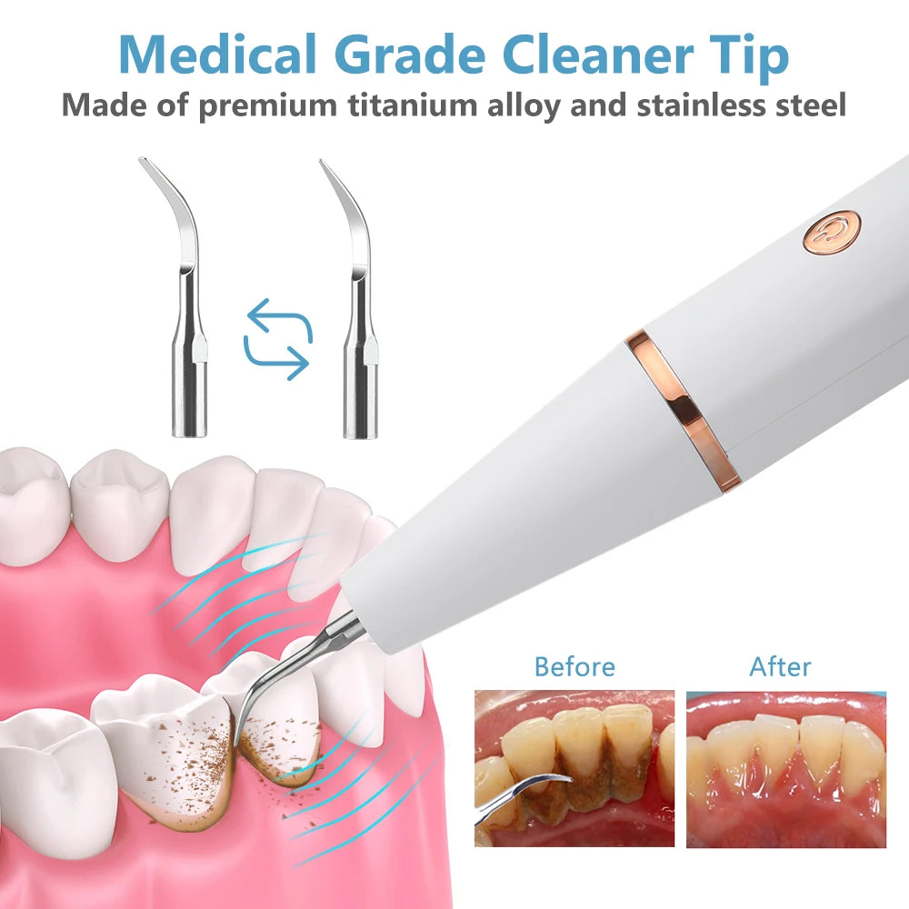 Hot Trend Vault Hailicare ultrasonic dental scaler for home use, removes calculus, stains, tartar, and whitens teeth.