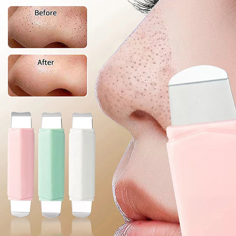 Hot Trend Vault blackhead removal tool, professional stainless steel nose spatula for deep cleansing on all skin types.
